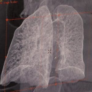 Columbia County Health System