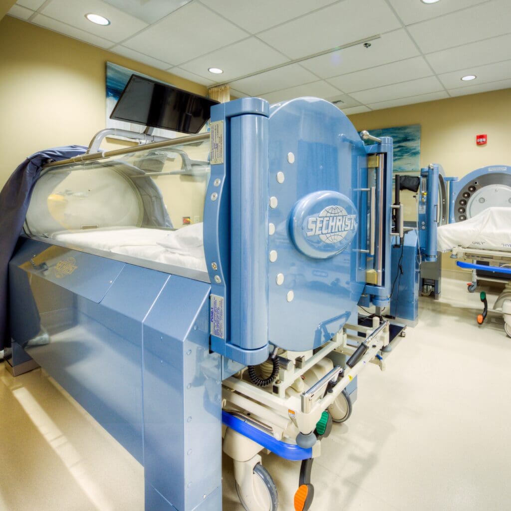 Hyperbaric chamber in a medical facility.